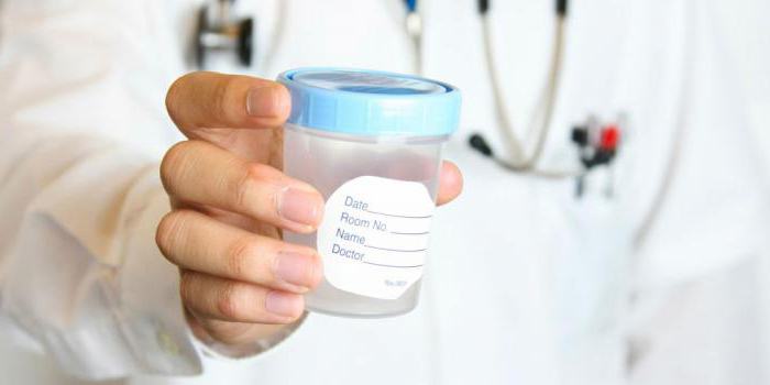 Dans quels cas un spermogramme est nécessaire ?